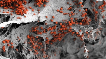 Imagen de microscopía electrónica de