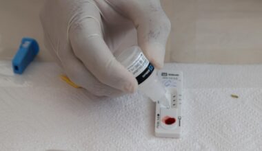 La incidencia del VIH aumentó en Aragón en 2024 con 107 casos nuevos | Aragon