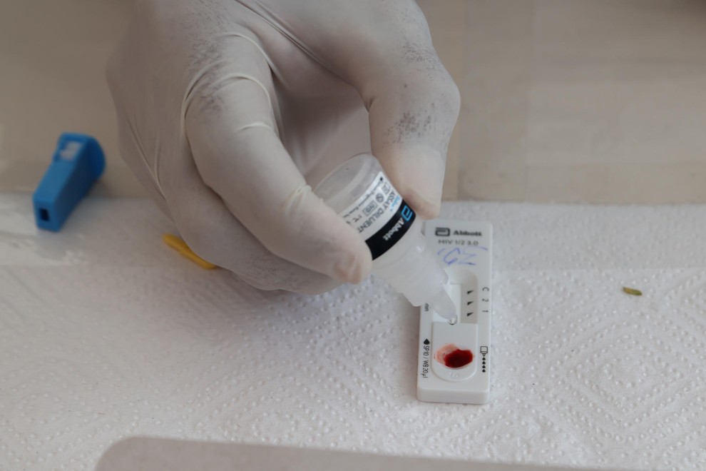 La incidencia del VIH aumentó en Aragón en 2024 con 107 casos nuevos | Aragon