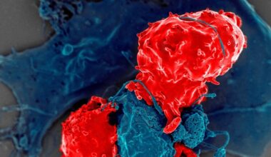 La inmunoterapia CAR-T llega a la forma más común de enfermedad cardíaca