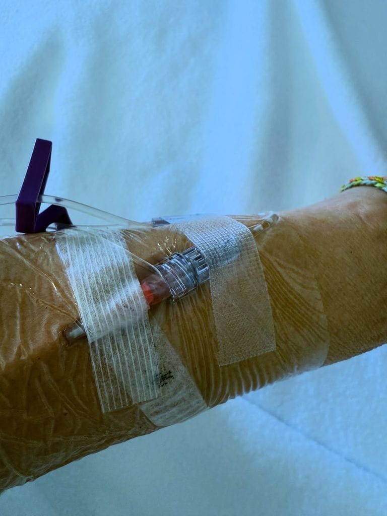 Ha mostrado su brazo con una vía con la medicación