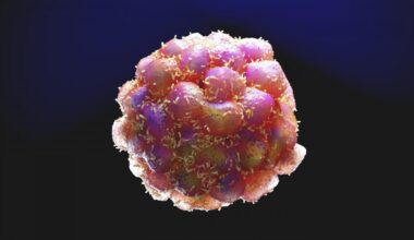 ¿Una estrategia para atacar debilidades ocultas de las células cancerosas?