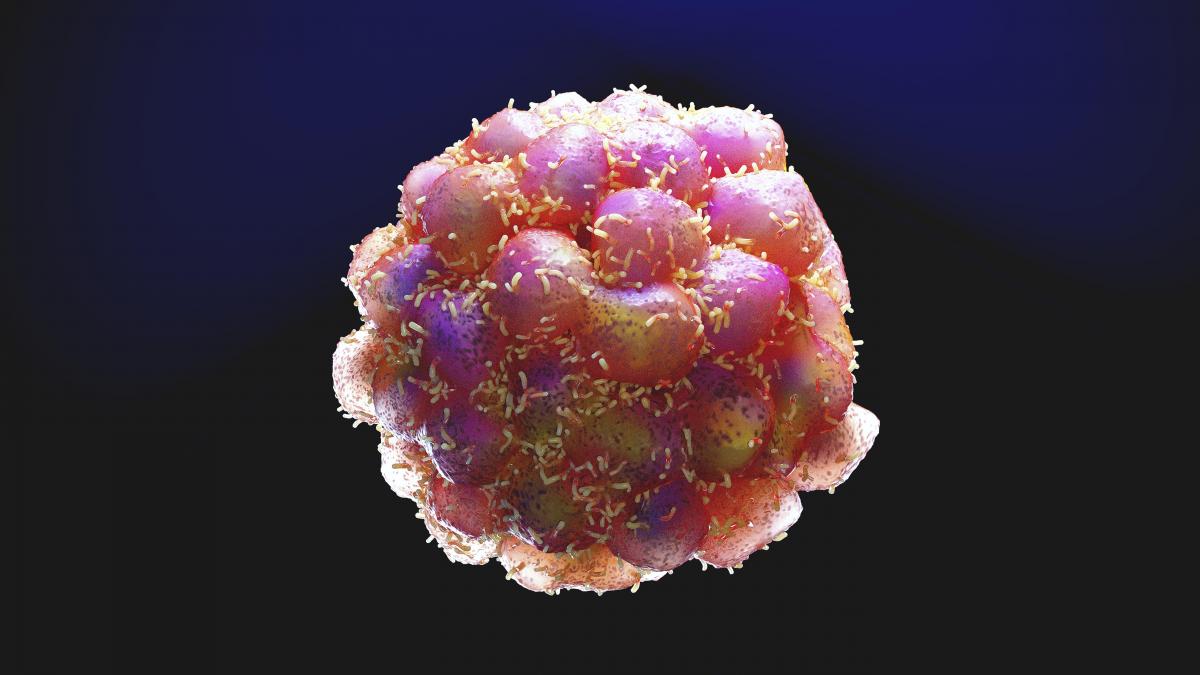 ¿Una estrategia para atacar debilidades ocultas de las células cancerosas?