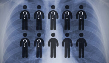 «No hay que tener complejo por ser enfermos»