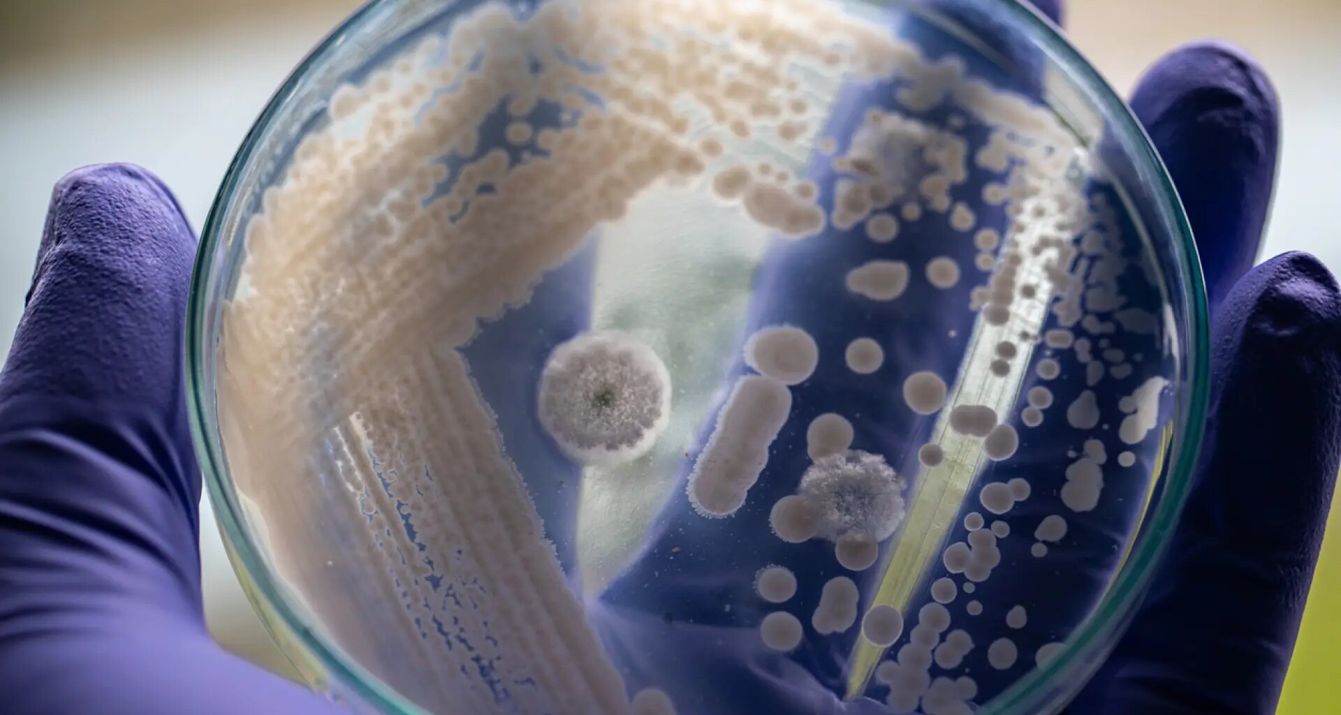 "Sobrevive en hospitales y equipo médico"