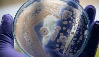 "Sobrevive en hospitales y equipo médico"