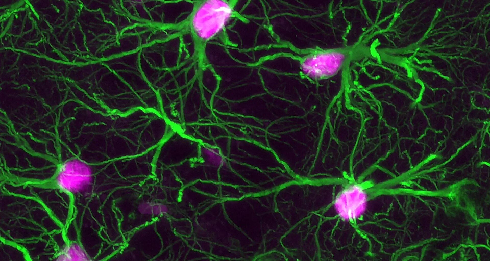 Científicos estadounidenses identifican la fuente en el cerebro que 'alimenta' la demencia
