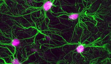 Científicos estadounidenses identifican la fuente en el cerebro que 'alimenta' la demencia
