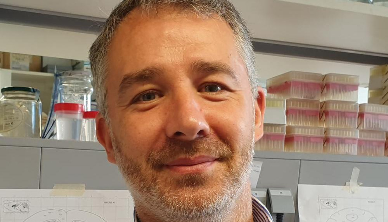 La investigación, liderada desde el grupo que dirige Miguel López, se enmarca en un proyecto que busca nuevos enfoques para luchar contra este síndrome caracterizado por desnutrición, atrofia muscular, fatiga y debilidad asociados al cáncer