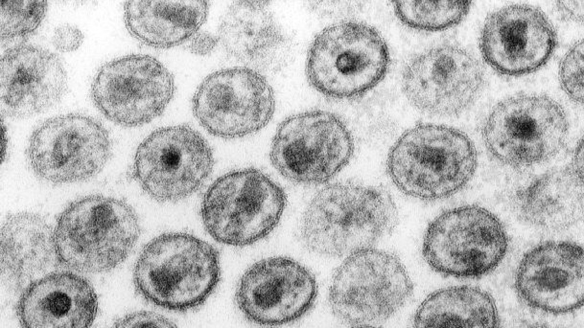 El proyecto en lo que colabora Anna Rull (IISPV) investiga los mecanismos que permiten a un pequeño grupo de pacientes controlar el VIH sin tratamiento