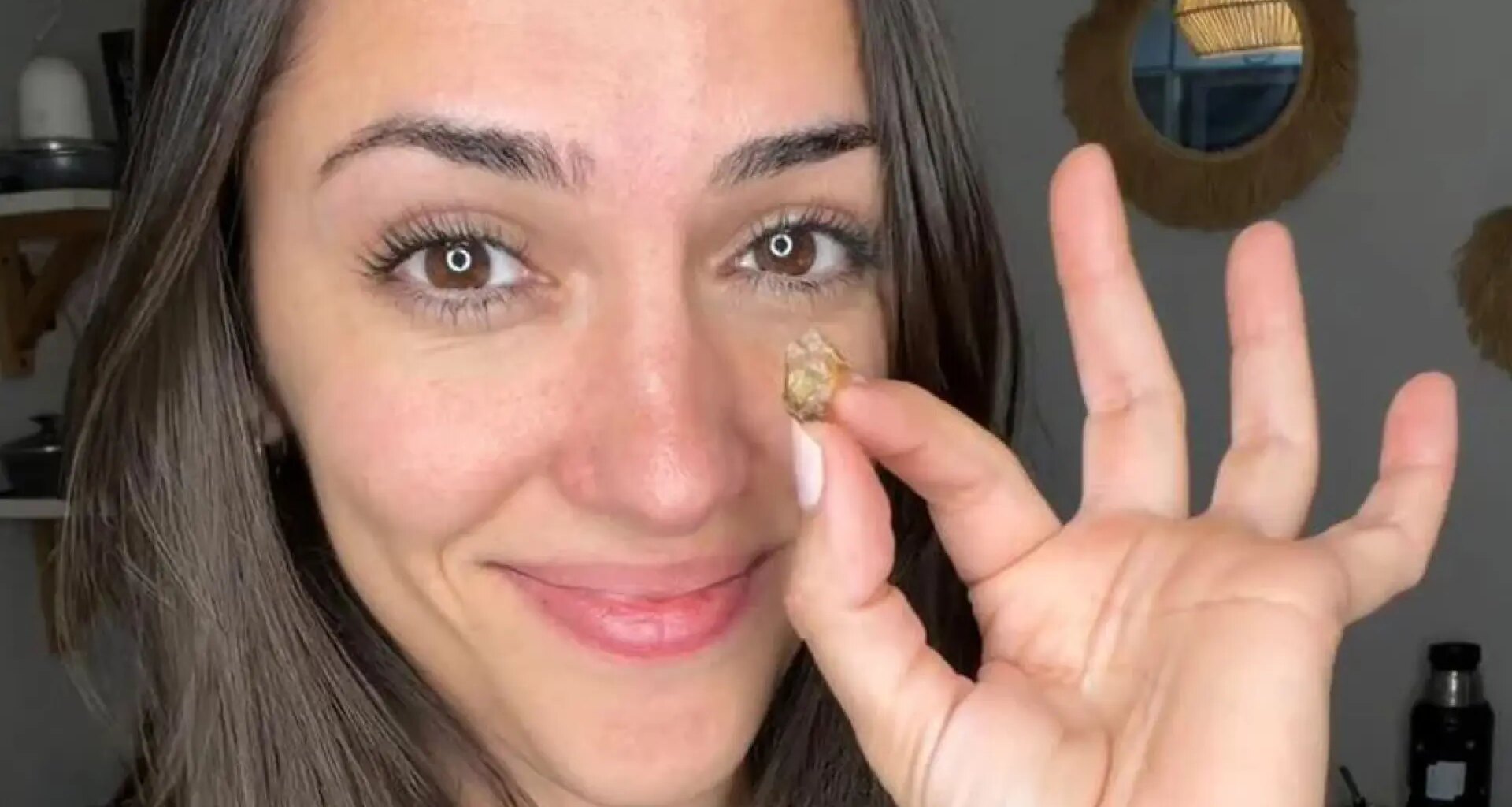 Extraen de la nariz de una 'influencer' un trozo de cinta adhesiva que llevaba insertado desde hace 35 años