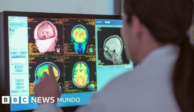 La adolescencia dura hasta los 30 años, según un nuevo estudio (y cuáles son las otras edades clave para el cerebro)