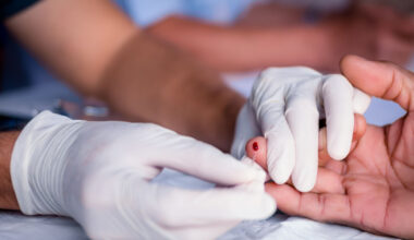 Preocupación por el aumento de infecciones por VIH en Canarias: 242 nuevos casos