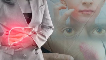 La importancia de la pérdida