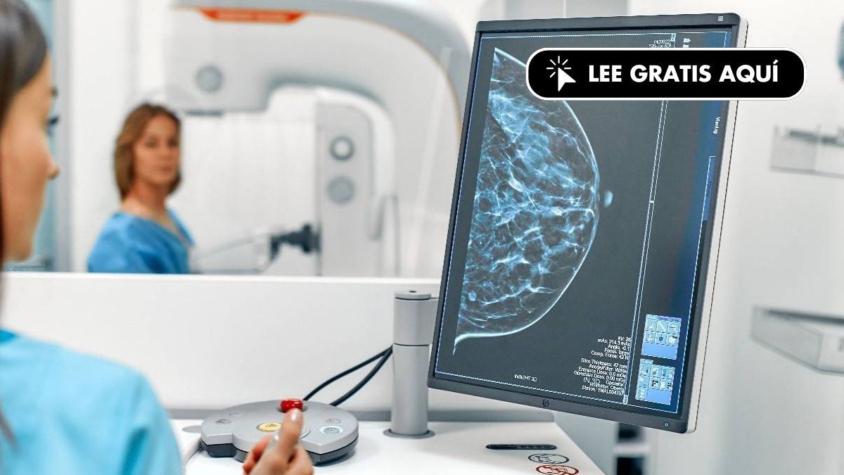 Una densidad mamográfica alta podría estar asociada con tumores de peor pronóstico