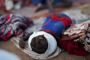 Un niño con una herida