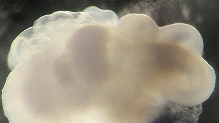 Organoide cerebral cultivado a partir de células de piel humana