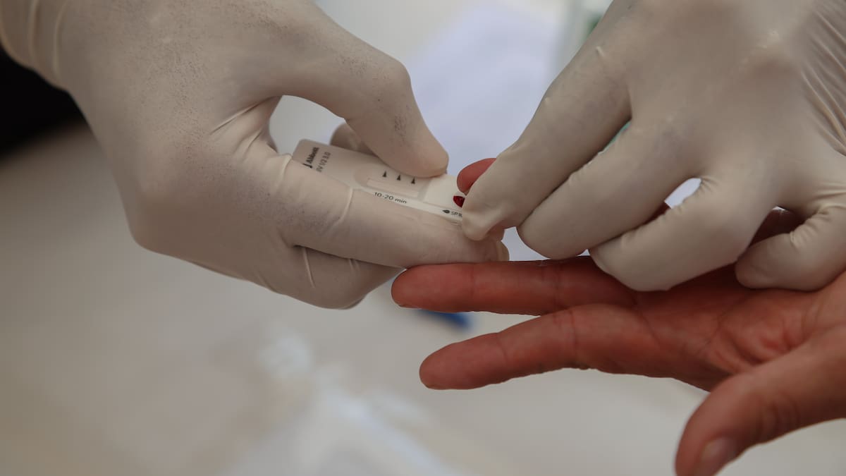 "No es un catarro": la importancia de la prevención del VIH en el Día Mundial del SIDA | Sociedad