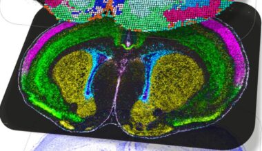 El atlas más detallado del cerebro revela cuándo y cómo surgen enfermedades como el autismo o la esquizofrenia
