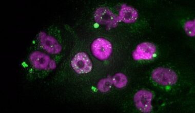 Lo que trae la investigación en el cáncer más letal: desde una ‘app’ para estimar riesgo personalizado, a fármacos más eficaces