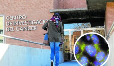 Palencia financia la investigación sobre el papel de una proteína en el cáncer de pulmón