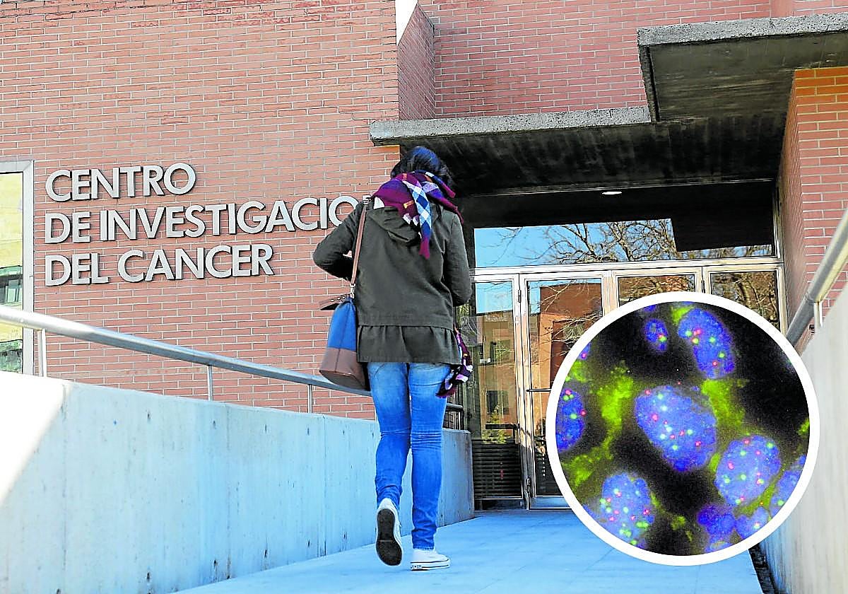 Palencia financia la investigación sobre el papel de una proteína en el cáncer de pulmón