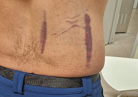 Imagen secundaria 1 - Armas incautadas a algunos de los agresores; en las fotos inferiores, parte de las marcas, aún visibles, del agente agredido en Entrevías, y carteles de burla tras el ataque a agentes de paisano en Alcalá