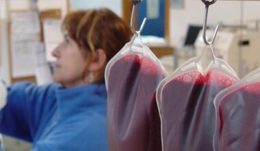 Identifican el primer caso autóctono humano de infección por el virus zoonoósico Usutu en España