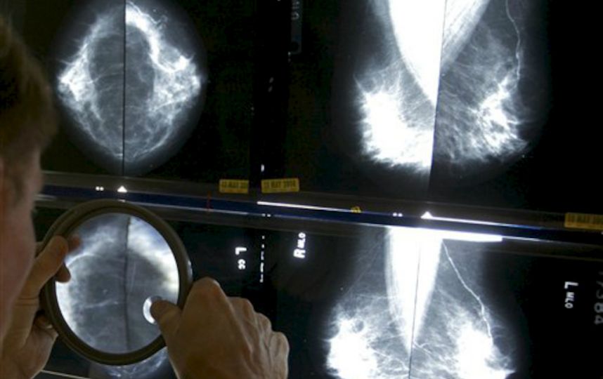 CamON-cáncer-mama- metastásico