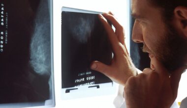 estadísticas y prevención del cáncer de próstata