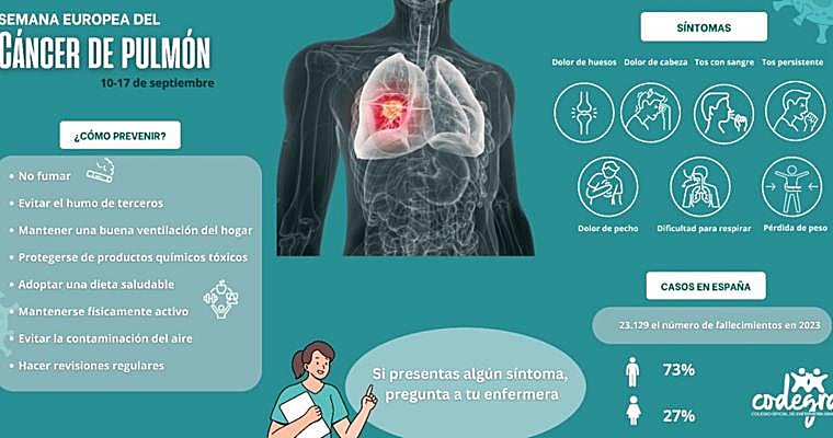 Oncólogos andaluces avisan del aumento del cáncer de pulmón en no fumadores: «No es una excepción ni una rareza clínica»