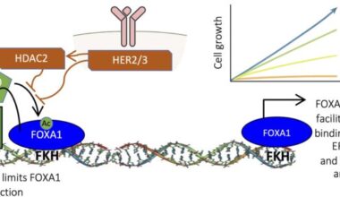 Demuestran cómo ciertos tumores de mama logran escapar a los tratamientos hormonales