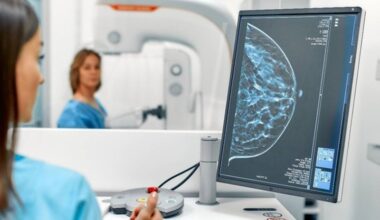 Identifican posible vínculo entre tumores agresivos y densidad mamográfica alta