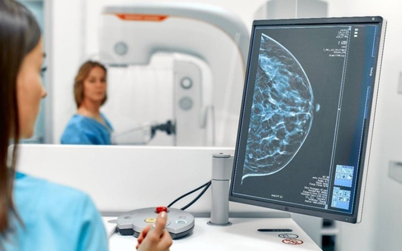Identifican posible vínculo entre tumores agresivos y densidad mamográfica alta