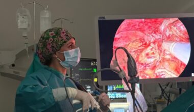 La detección temprana del cáncer de pulmón puede mejorar la tasa de superviviencia hasta el 80%