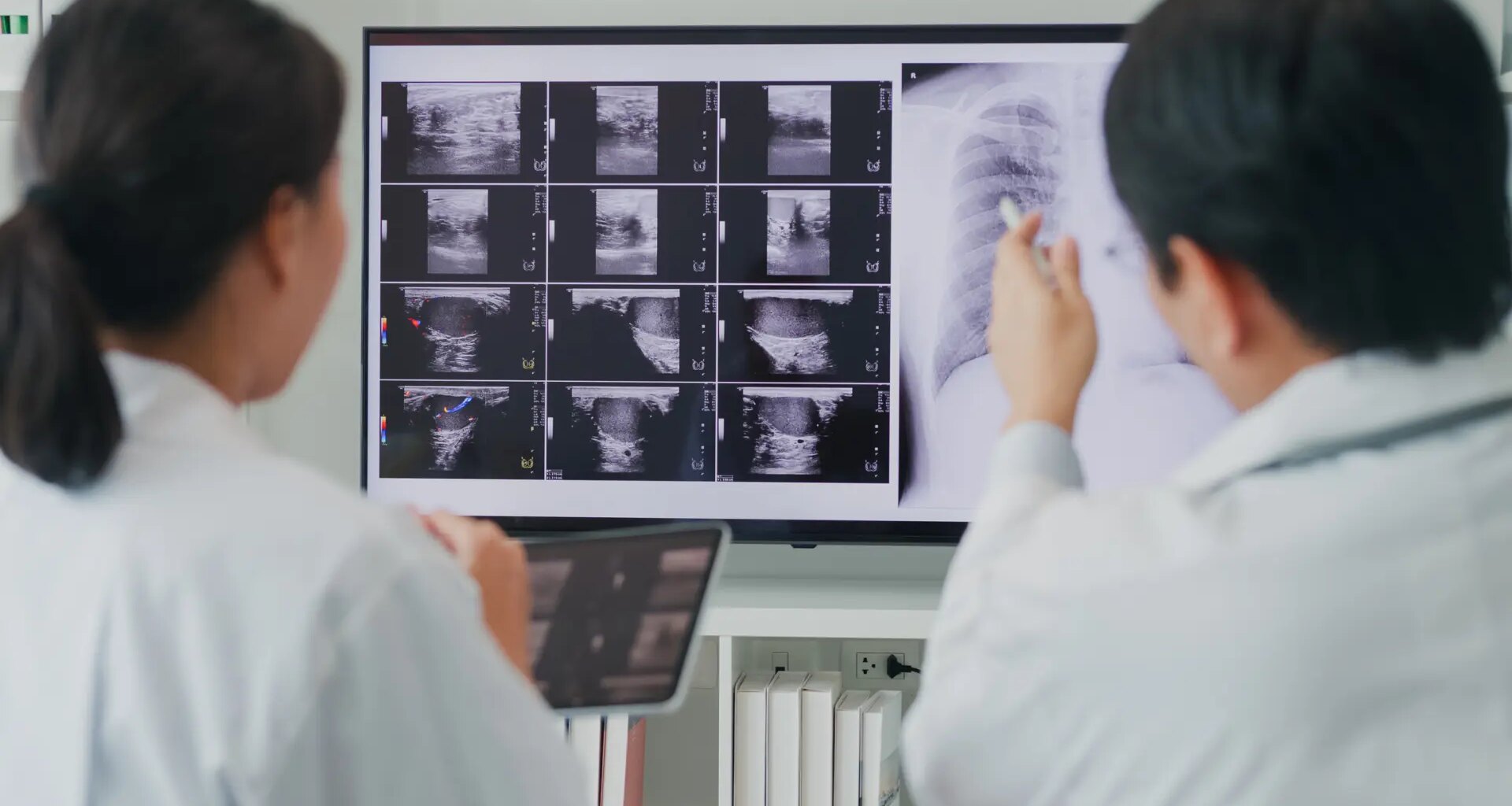 El gen que cambió los pronósticos del cáncer de pulmón no microcítico y mejoró su tratamiento