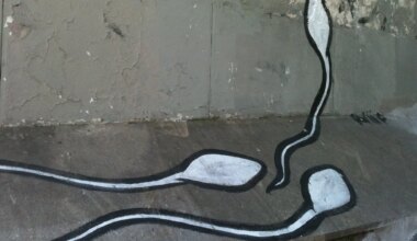 Logran un embarazo imposible gracias a la selección del mejor esperma con Inteligencia Artificial