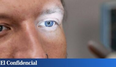 Prueban con éxito en humanos el tratamiento que regenera la vista perdida con la edad