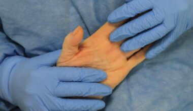 La importancia de diagnosticar la desnutrición por enfermedad