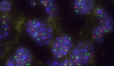 la proteína que emerge como nueva diana para tumores pulmonares con mutaciones KRAS y TP53