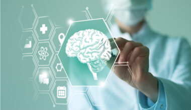 Nuevo recurso global de datos clínicos y de imagen para acelerar la investigación sobre la esclerosis múltiple progresiva