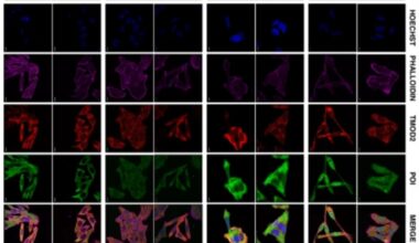 Proteína clave en el cáncer colorrectal identificada