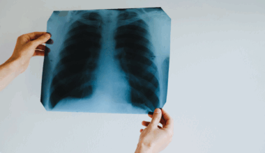 El 75 de los casos de EPOC siguen sin diagnosticar