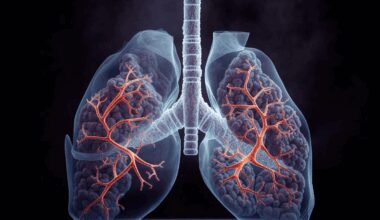 Más de una de cada cuatro muertes por neumonía se debe a la contaminación del aire y al tabaquismo