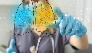 Ese 'trancazo' es otra cosa... y se llama neumonía