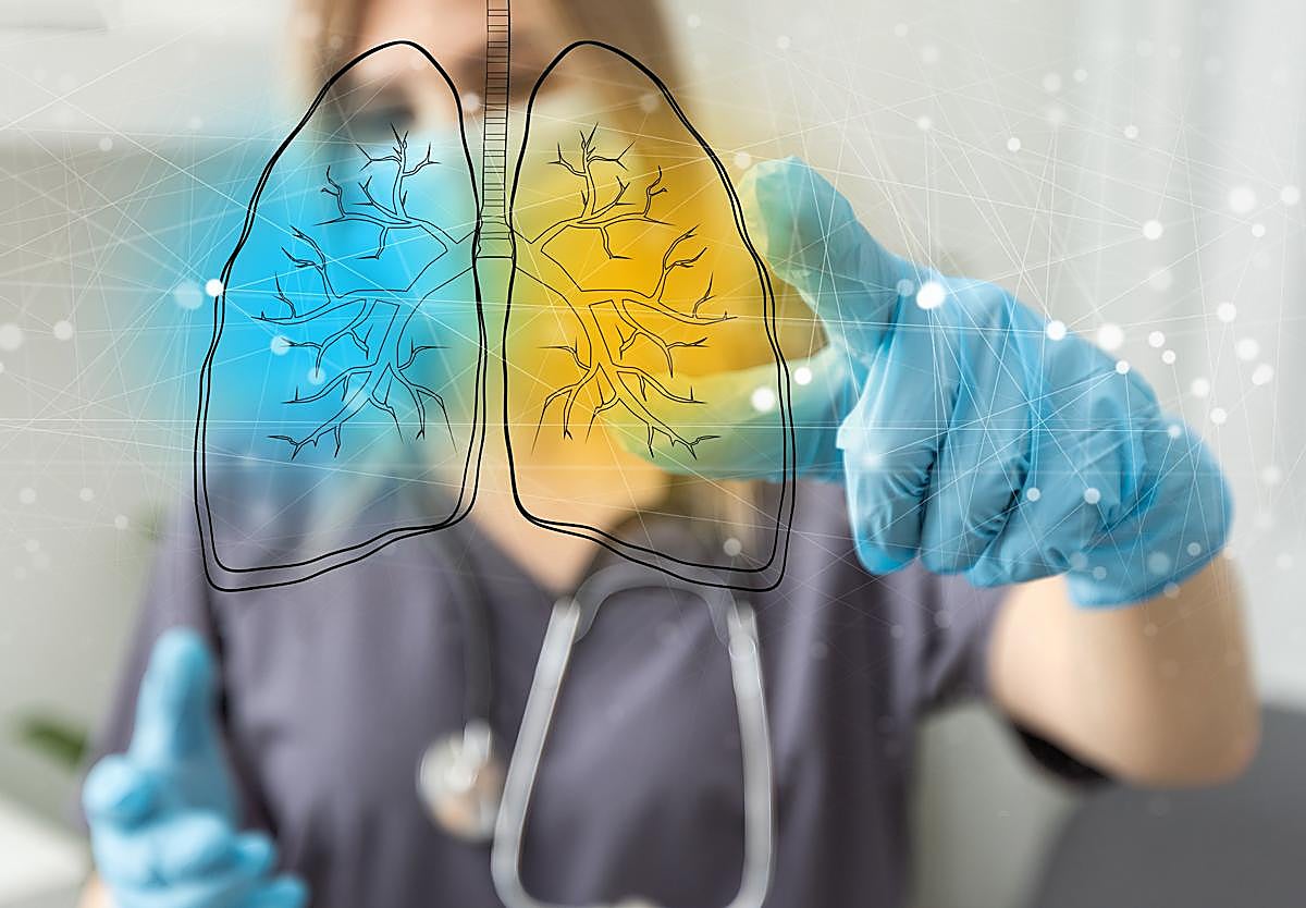 Ese 'trancazo' es otra cosa... y se llama neumonía