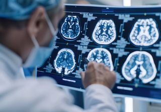 El Parkinson puede comenzar en un órgano inesperado del cuerpo y no en el cerebro, según unos neurólogos en Nature