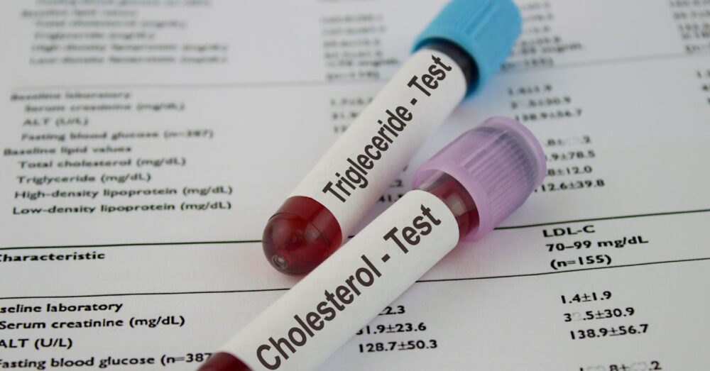 Nueva pastilla reduce el colesterol LDL casi un 60%: avance para hipercolesterolemia familiar