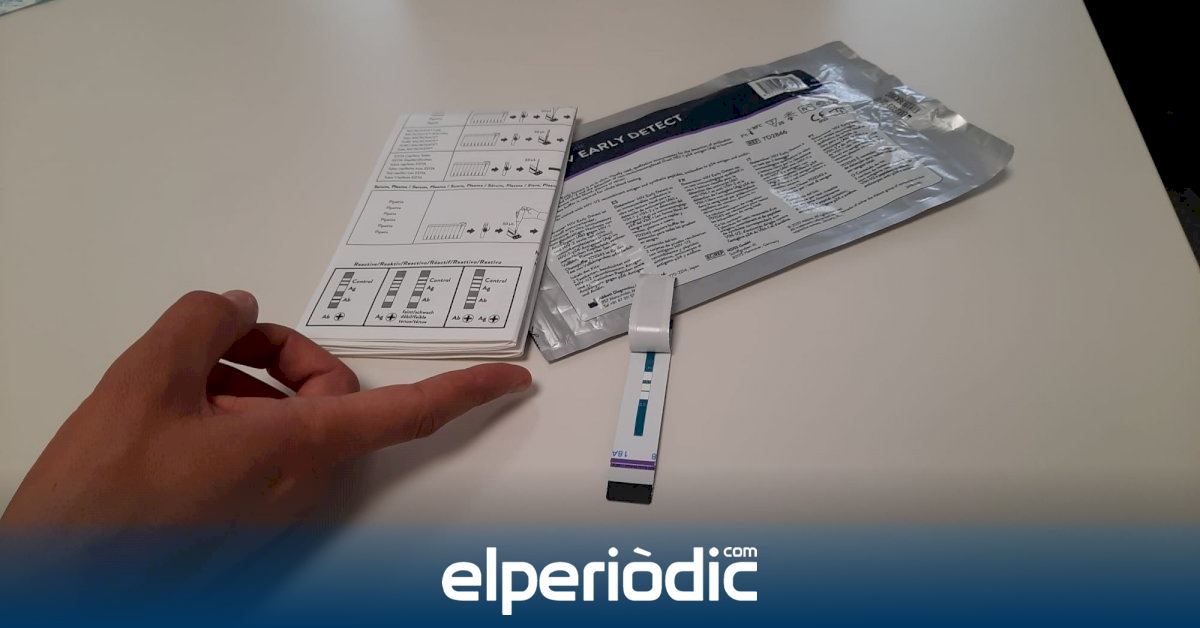 Los Centros de Información y Prevención del Sida atendieron cerca de 18.000 consultas y realizaron más de 8.000 pruebas de VIH el pasado año