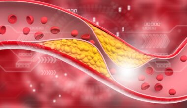 LDL más bajos, estatinas y alternativa natural